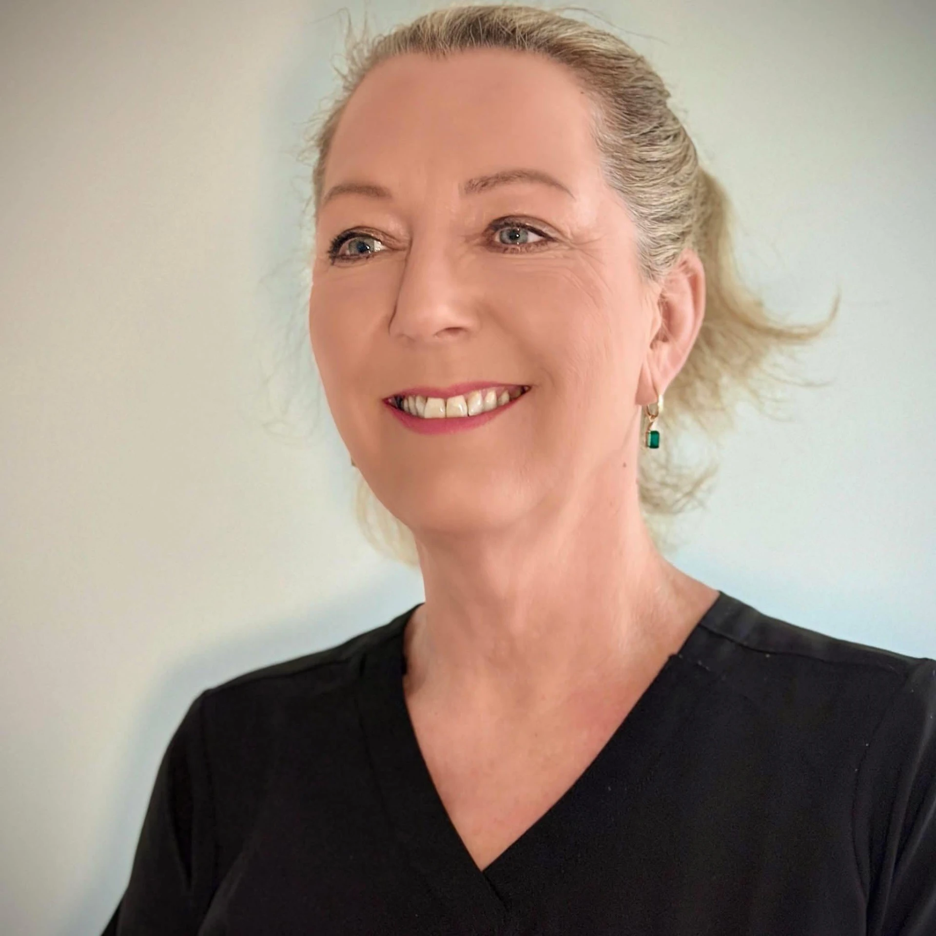 Siw – eier av SkinSence